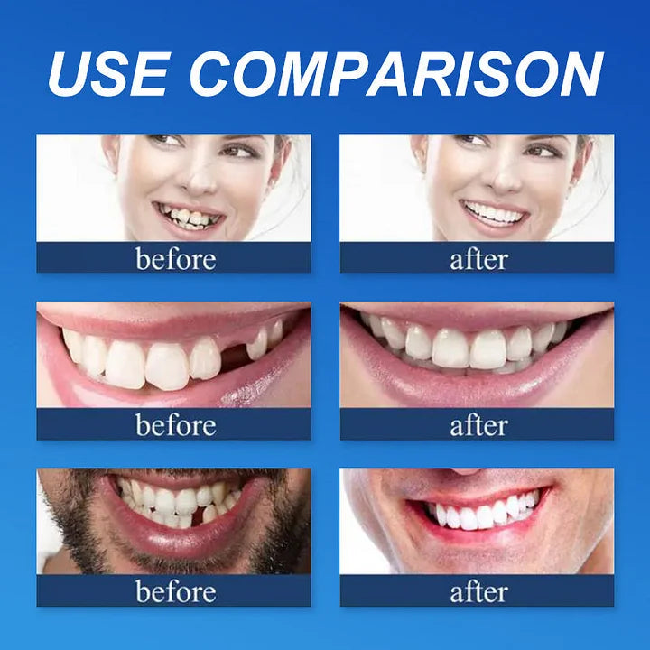 Ends Today: 70% OFF! ⏰DarkFairy™ Medical Full Denture with Strong Suctiond🦷